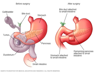 Illustration for article titled Momlock update (TW: surgery illustration)